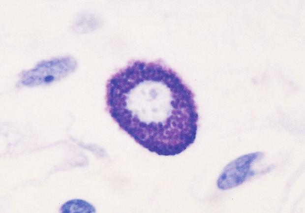 6 Parte I Introdução à Imunobiologia e à Imunidade Inata ao seu núcleo de forma estranha.