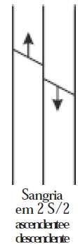 16. COLHEITA Direção do Corte Sangria ascendente - realizada num ângulo de 45º, de baixo para cima. É utilizado em balanceamento de painel ou no término da vida útil da árvore.