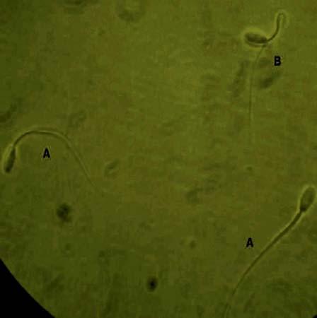 Figura 5 - Morfologia espermática do ejaculado submetido ao teste com dimetilformamida observado em microscópio de contraste de fase. Aumento de 1000X.
