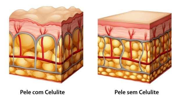 7 A camada mais externa, epiderme, é composta por várias camadas finas em diferentes estágios de maturação.