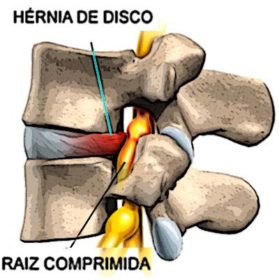 COLUNA VERTEBRAL