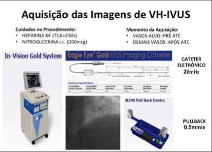Métodos 17 Figura 2 - Dispositivos utilizados para aquisição das imagens de VH- IVUS VH-IVUS = ultrassom intravascular com histologia virtual.