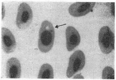 2.2. Estudo das formas do plasmódio: a) Esquizogônia eritrocítica O estudo das formas eritrocíticas do Plasmodium (S.
