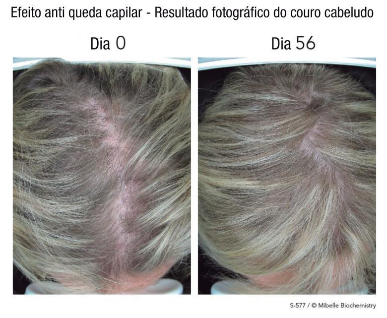 5. Dosagem indicada AnaGain TM pode ser utilizado por via oral na concentração de 100mg ao dia, devendo ser tomado diariamente para melhores resultados. 6.