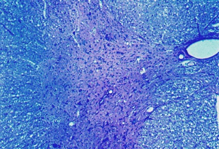 As células ependimárias (epêndima) são células cúbicas ou colunares, com núcleo ovoide, prolongamentos na superfície basal e microvilos ou cílios na superfície apical.