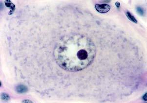 T. Montanari, UFRGS Figura 4.25 - Neurônio pseudounipolar do gânglio sensorial. HE. Objetiva de 100x (851x). Figura 4.26 - Neurônio pseudounipolar com célula satélite adjacente na microscopia eletrônica.