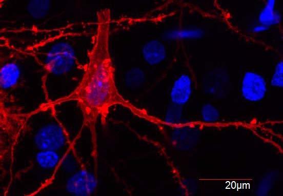 D A D Figura 4.6 - Microscopia confocal de neurônio piramidal do córtex motor de rato, onde são indicados dendritos (D), axônio (A), espículas dendríticas ( ) e botões sinápticos ( ).