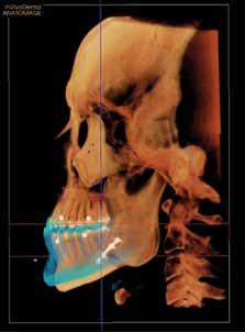 Daí que se tenham criado as primeiras simulações em 3D, através de sofisticadas máquinas fotográficas, que efectuavam três fotografias ao mesmo tempo e cuja informação transpunha-se depois para um