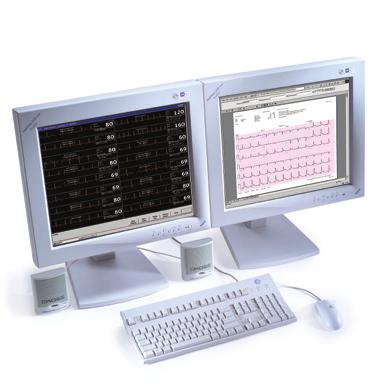 Central de Monitoração icentral* Monitorização em tempo real até 32 pacientes por Central, com múltiplas formas de onda; Permite conexão com mais de 32