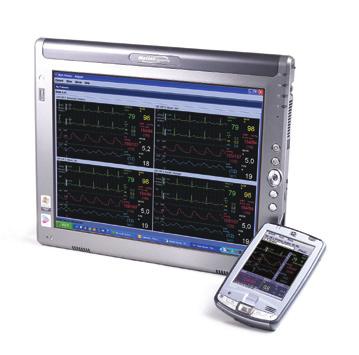 CiC PRO* Monitora em tempo real até 16 pacientes, com múltiplas formas de onda; Análise e edição posterior de até 72 horas de gravação do ECG (Full