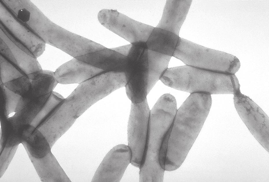 5 1. INTRODUÇÃO As bactérias do género Legionella encontram-se em ambientes aquáticos naturais e também em sistemas artificiais, como redes de abastecimento/distribuição de água, redes prediais de