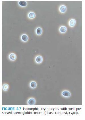 [1] Eritrócitos isomórficos
