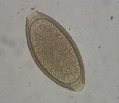 Resultados e Discussão De um total de 47 amostras analisadas nos exames coproparasitológicos, 17 (36,2%) apresentaram um ou mais gêneros parasitários e 30 (63,8%) tiveram resultado negativo.