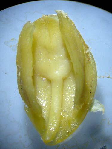 Embryo 20a