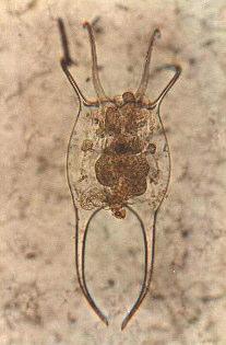 Conochilus dossuarius;