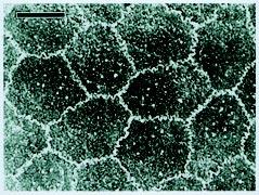 Figura 1. Eletromicrografia de varredura do endotélio corneano de coelho. Notar células poligonais uniformes em tamanho e forma (1500 X. Barra = 10 µm). Figura 2.