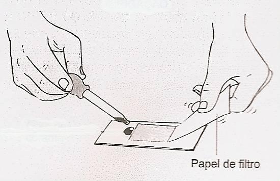 7. 4- Discussão 4.1 Interpreta as diferenças entre as preparações A e B, sabendo que a cor das pétalas é devida à presença de determinados pigmentos nos vacúolos.