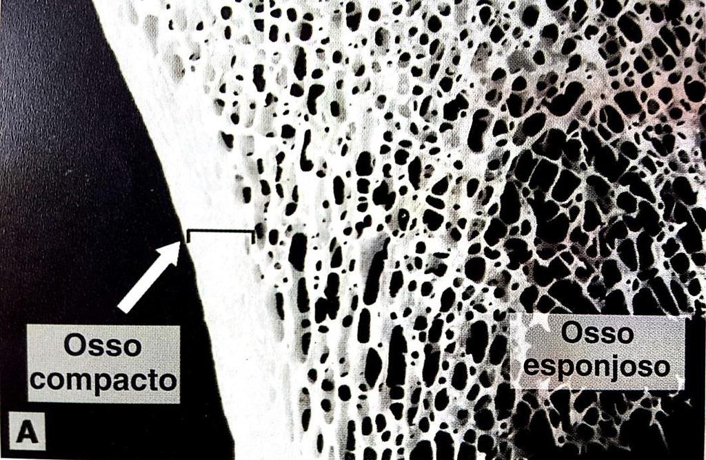 TECIDO ÓSSEO CLASSIFICAÇÃO MACROSCÓPICA Osso Esponjoso Partes com muitas cavidades
