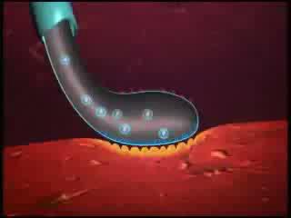 b) O Clostridium perfringens produz endoenterotoxina no intestino, quando ocorre esporulação, após a ingestão de grande quantidade de formas vegetativas, sendo um dos exemplos clássicos de agente