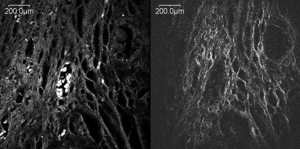 Figura 2: A imagem da esquerda mostra um mapa sinal de autofluorescência do corte de tecido. A imagem da direita mostra o SHG obtido na mesma região.