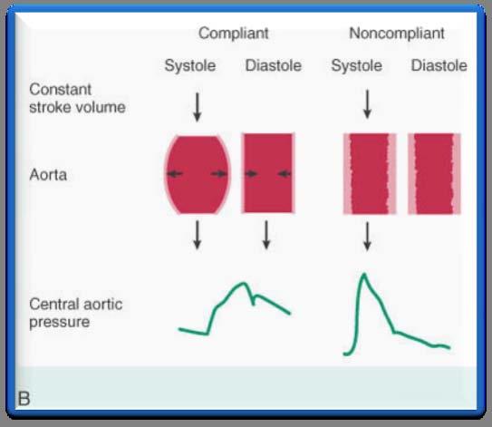 Formas Hemodinâmicas Hipertensão Sistólica