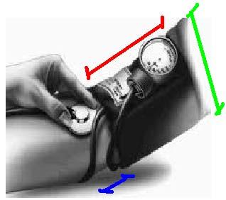 Diagnóstico da HAS Medida 1.Estimar PAS no pulso radial 2.