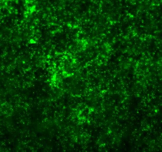 41 Tabela 7. Distribuição dos grânulos corticais dos ovócitos imaturos e maturados in vitro tratados ou não com 10 e 100 µm de BL I.