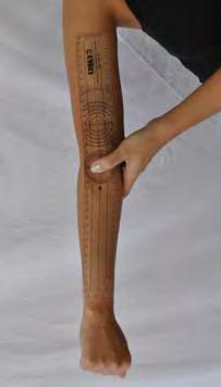 Figura 3: Hiperextensão ativa do Figura 4: Hiperextensão do joelho cotovelo Figura 5: Flexão do tronco