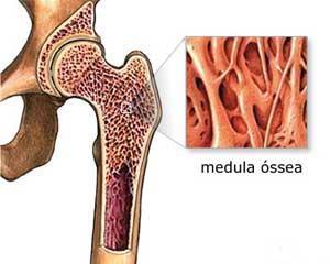 1. Introdução 1. Introdução 1.1. Medula óssea: localização e caracterização macro e microscópica A medula óssea é um tecido de consistência gelatinosa, que contém uma densa rede de sinusóides