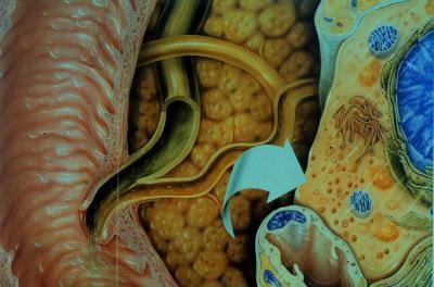 Opie - 1901 pancreatite aguda biliar -