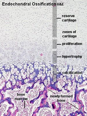 cartilagem hipertrófica Zona de