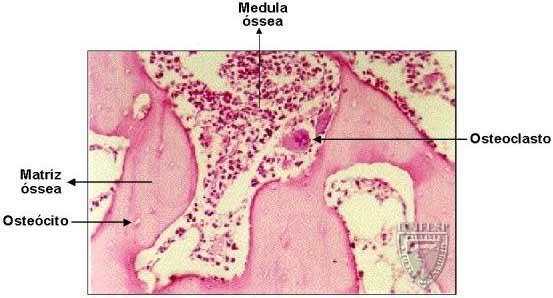 Células constituintes Osteoclastos: Móveis, gigantes, ramificadas e multinucleadas; Originárias de células mononucleadas da