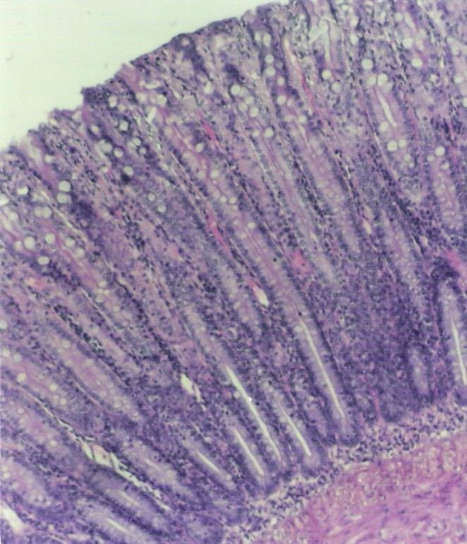 O epitélio é, portanto, simples colunar com microvilos e células caliciformes (Figura 8.17). Contém ainda células precursoras e células endócrinas. Ele se invagina formando as glândulas de Lieberkühn.