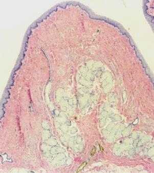 Para diminuir esse atrito, o epitélio é lubrificado por um muco produzido pelas glândulas esofágicas da submucosa. Essas glândulas são tubuloacinosas, ramificadas e seromucosas.