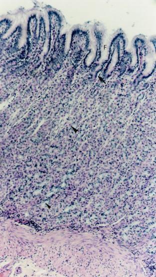 Figura 8.13 - As células mucosas superficiais e as células mucosas do colo ( ) são identificadas pela coloração magenta das glicoproteínas.