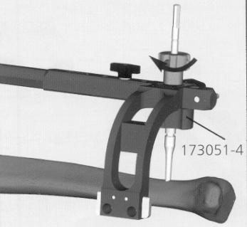 Montar o Adaptador Distal (174160) em cima do Braço Distal, e montar o Braço Distal Alvo (174170) normalmente no lado medial.