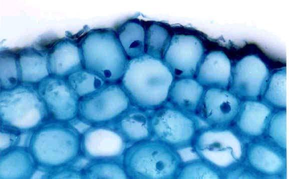 Nota-se a presença de cutícula fina, pêlos radiculares e tricomas, o mesmo observado por vários autores em Estua (1972).