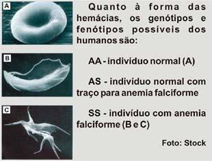 a) A malária a.nge, preferencialmente, indivíduos com anemia falciforme. b) Os indivíduos heterozigotos têm menor chance de contrair o Plasmodium.