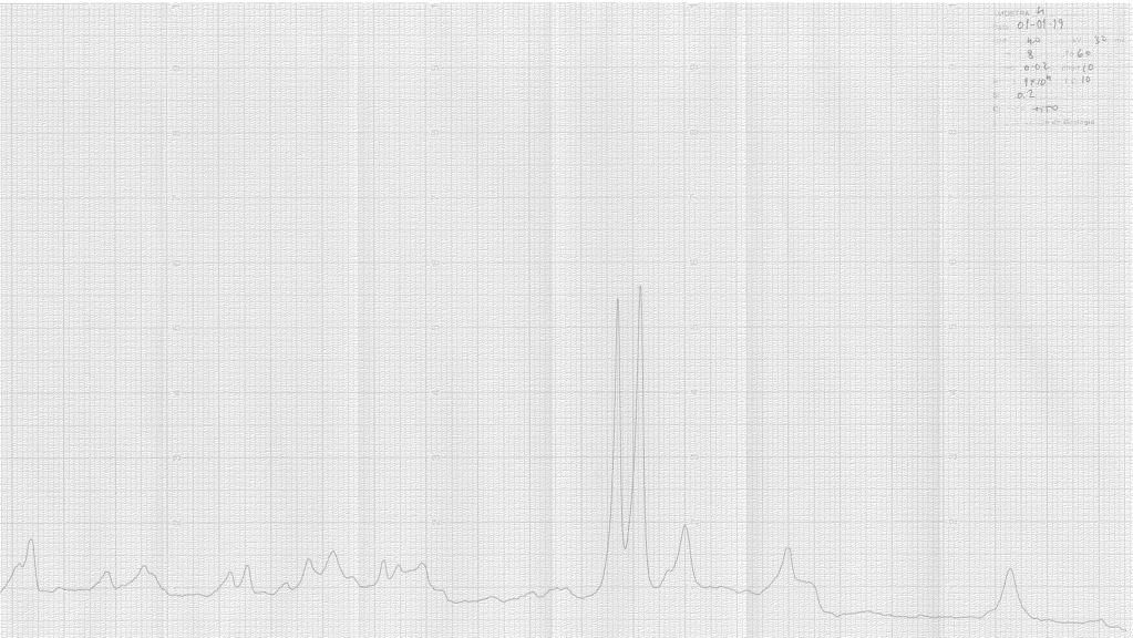 Melhoramento dos Solos com a Adição de Cal