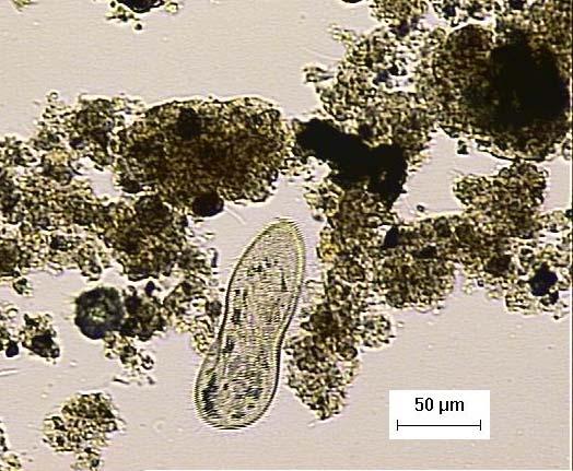 (A) (B) Figura 4 - (A) Presença de ciliado livre-natante do gênero Paramecium no licor da lagoa de