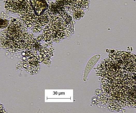 (B)Presença de nematóide no licor da lagoa de aeração que não recebeu resíduo de ETA.