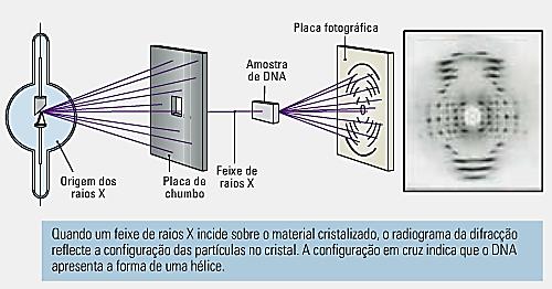 (1916- ) Interpretação de radiogramas da