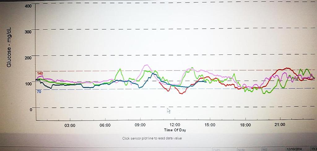 dos três dias de uma paciente do grupo DMG1 e outra do grupo NDM. Figura 1 Traçado do CGMS de uma paciente do grupo NDM.