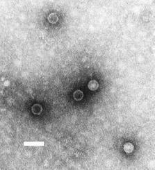 REPRODUÇÃO CICLO LÍTICO DNA ou RNA do vírus caracteriza uma infecção (doença).