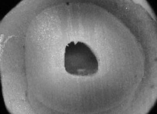 Avaliação da superfície dentinária com o microscópio clínico forma, formou-se o corpo de prova (Figura 3). Aguardou-se o período de três horas da inclusão para a polimerização da resina.