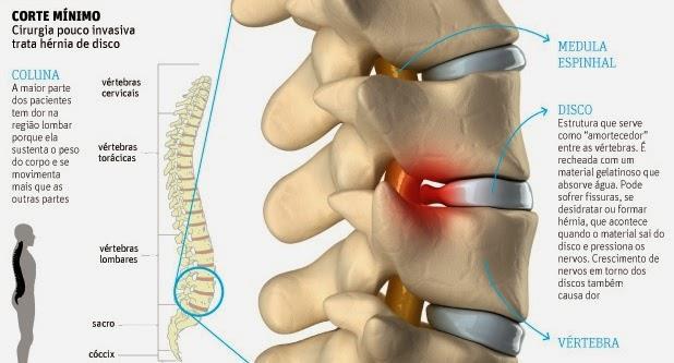 Cada vértebra sustenta o peso de todas as partes do corpo situadas acima dela. http://fisioprimemg.blogs pot.com.