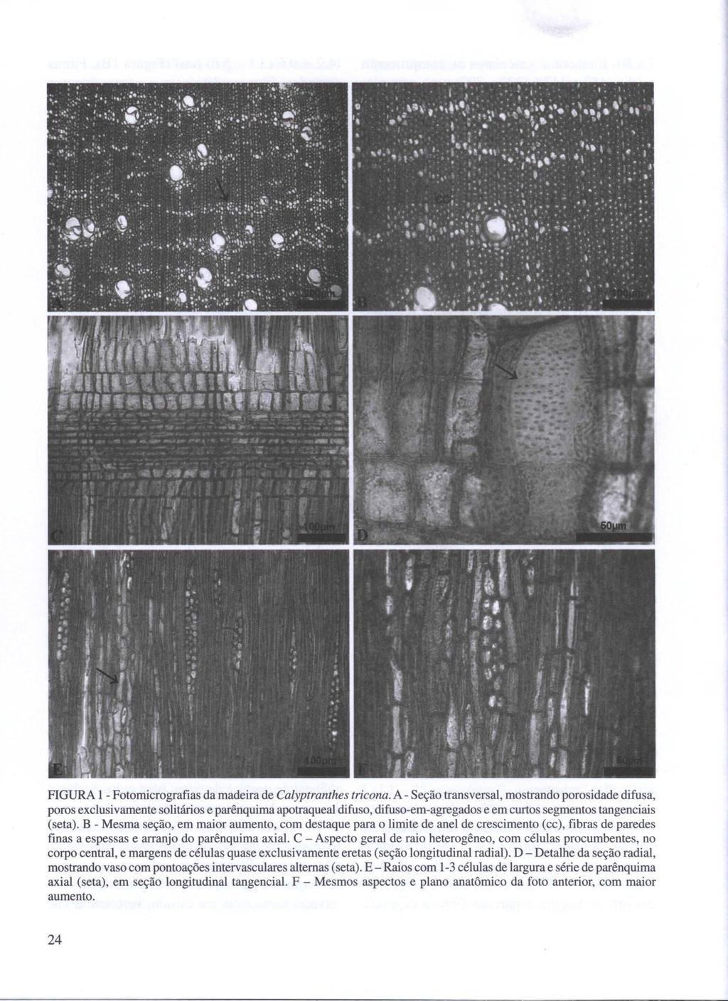 FIGURA 1 - Fotomicrografias da madeira de Calyptranthes tricona.