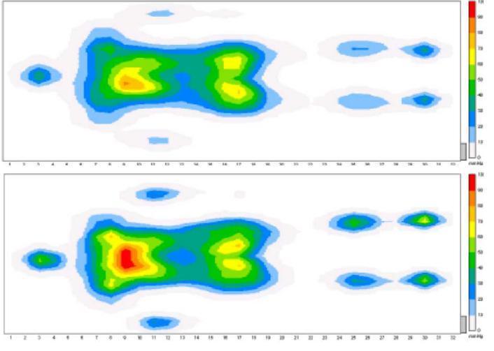 Características Viscoelásticas Fator de conforto e distribuição