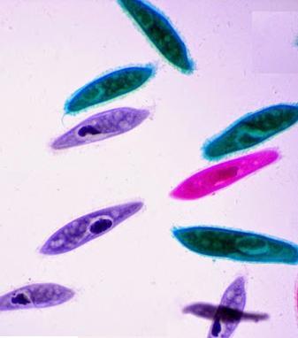 b) Os cientistas, após alguns anos, chegaram à conclusão que a piramboia não era um anfíbio, mas sim, um peixe. DIFERENCIE esses dois grupos de vertebrados.