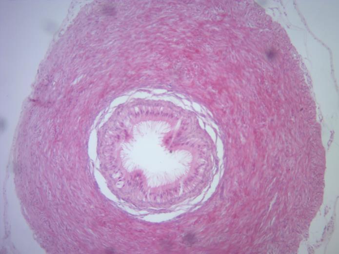 Os túbulos retos levam para a rede testicular, que são labirintos revestidos por epitélio simples cúbico, os espermatozóides imaturos.